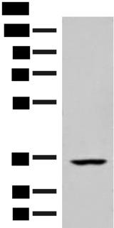 FBXO16 Antibody - Western blot analysis of Human heart tissue lysate  using FBXO16 Polyclonal Antibody at dilution of 1:400