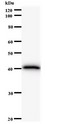 FBXO18 / FBH1 Antibody - Western blot of immunized recombinant protein using FBXO18 antibody.