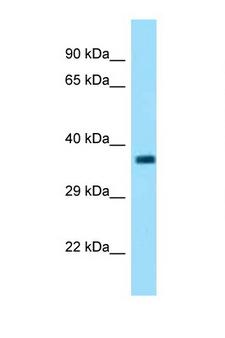 FBXO2 Antibody - FBXO2 antibody Western blot of Small Intestine lysate. Antibody concentration 1 ug/ml.  This image was taken for the unconjugated form of this product. Other forms have not been tested.