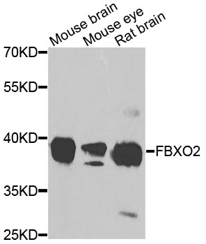 FBXO2 Antibody - Western blot analysis of extracts of various cells.