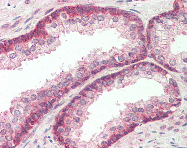 FBXO21 Antibody - Anti-FBXO21 antibody IHC staining of human prostate. Immunohistochemistry of formalin-fixed, paraffin-embedded tissue after heat-induced antigen retrieval. Antibody concentration 10 ug/ml.  This image was taken for the unconjugated form of this product. Other forms have not been tested.