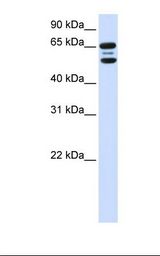 FBXO21 Antibody - 293T cell lysate. Antibody concentration: 1.0 ug/ml. Gel concentration: 12%.  This image was taken for the unconjugated form of this product. Other forms have not been tested.