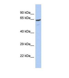 FBXO21 Antibody - Western blot of Human OVCAR-3. FBXO21 antibody dilution 1.0 ug/ml.  This image was taken for the unconjugated form of this product. Other forms have not been tested.