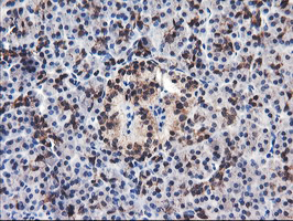 FBXO21 Antibody - IHC of paraffin-embedded Human pancreas tissue using anti-FBXO21 mouse monoclonal antibody.