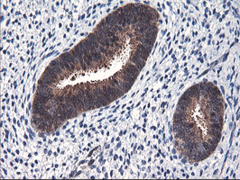 FBXO21 Antibody - IHC of paraffin-embedded Human endometrium tissue using anti-FBXO21 mouse monoclonal antibody.