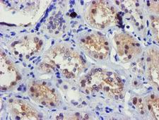 FBXO21 Antibody - IHC of paraffin-embedded Human Kidney tissue using anti-FBXO21 mouse monoclonal antibody. (Heat-induced epitope retrieval by 10mM citric buffer, pH6.0, 100C for 10min).