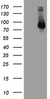 FBXO21 Antibody - HEK293T cells were transfected with the pCMV6-ENTRY control (Left lane) or pCMV6-ENTRY FBXO21 (Right lane) cDNA for 48 hrs and lysed. Equivalent amounts of cell lysates (5 ug per lane) were separated by SDS-PAGE and immunoblotted with anti-FBXO21.