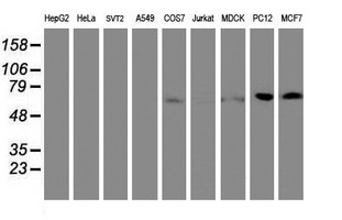 FBXO21 Antibody - Western blot of extracts (35ug) from 9 different cell lines by using anti-FBXO21 monoclonal antibody.