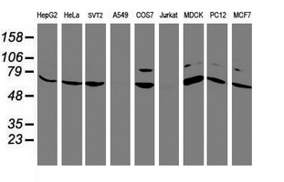 FBXO21 Antibody - Western blot of extracts (35 ug) from 9 different cell lines by using anti-FBXO21 monoclonal antibody.
