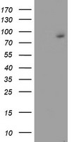 FBXO21 Antibody - HEK293T cells were transfected with the pCMV6-ENTRY control (Left lane) or pCMV6-ENTRY FBXO21 (Right lane) cDNA for 48 hrs and lysed. Equivalent amounts of cell lysates (5 ug per lane) were separated by SDS-PAGE and immunoblotted with anti-FBXO21.
