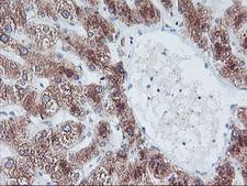 FBXO21 Antibody - IHC of paraffin-embedded Human liver tissue using anti-FBXO21 mouse monoclonal antibody. (Heat-induced epitope retrieval by 10mM citric buffer, pH6.0, 100C for 10min).