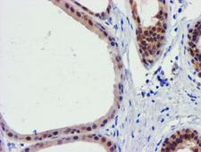 FBXO21 Antibody - IHC of paraffin-embedded Human breast tissue using anti-FBXO21 mouse monoclonal antibody.