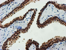 FBXO21 Antibody - IHC of paraffin-embedded Human prostate tissue using anti-FBXO21 mouse monoclonal antibody.