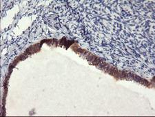 FBXO21 Antibody - IHC of paraffin-embedded Human Ovary tissue using anti-FBXO21 mouse monoclonal antibody.