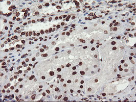 FBXO21 Antibody - IHC of paraffin-embedded Human Kidney tissue using anti-FBXO21 mouse monoclonal antibody.