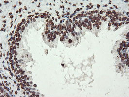 FBXO21 Antibody - IHC of paraffin-embedded Human prostate tissue using anti-FBXO21 mouse monoclonal antibody.