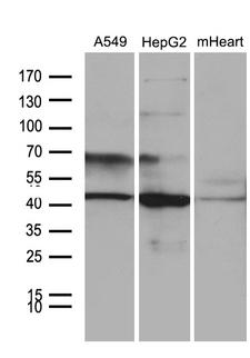 FBXO22 Antibody - Western blot analysis of extracts. (35ug) from 2 different cell lines and mouse heart tissue lysate by using anti-FBXO22 monoclonal antibody. (1:500)