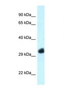 FBXO22 Antibody - FBXO22 antibody Western blot of Mouse Heart lysate. Antibody concentration 1 ug/ml.  This image was taken for the unconjugated form of this product. Other forms have not been tested.