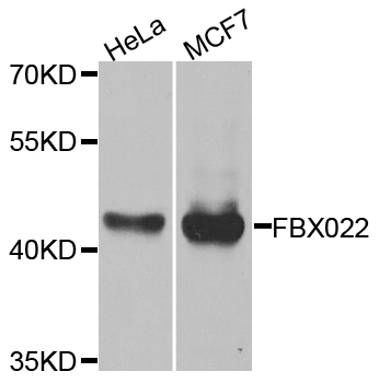 FBXO22 Antibody - Western blot analysis of extracts of various cell lines.