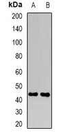 FBXO22 Antibody - Western blot analysis of FBXO22 expression in HeLa (A); MCF7 (B) whole cell lysates.