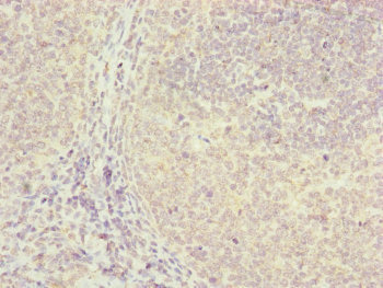 FBXO22 Antibody - Immunohistochemistry of paraffin-embedded human tonsil tissue at dilution of 1:100
