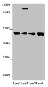 FBXO22 Antibody - Western blot All Lanes:FBXO22 antibody at 1.98 ug/ml Lane 1: Mouse heart tissue Lane 2: Hela whole cell lysate Lane 3: MCF7 whole cell lysate Lane 4: HepG-2 whole cell lysate Secondary Goat polyclonal to rabbit IgG at 1/10000 dilution Predicted band size: 45,5,31 kDa Observed band size: 45,110 kDa