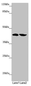 FBXO22 Antibody - Western blot All Lanes:FBXO22 antibody at 2.42 ug/ml Lane 1: Mouse heart tissue Lane 2: Mouse liver tissue Secondary Goat polyclonal to rabbit IgG at 1/10000 dilution Predicted band size: 45,5,31 kDa Observed band size: 45 kDa