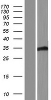 FBXO22 Protein - Western validation with an anti-DDK antibody * L: Control HEK293 lysate R: Over-expression lysate