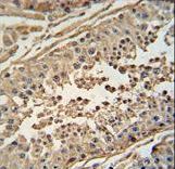 FBXO24 Antibody - FBXO24 antibody immunohistochemistry of formalin-fixed and paraffin-embedded human testis tissue followed by peroxidase-conjugated secondary antibody and DAB staining.
