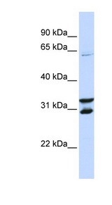 FBXO24 Antibody - FBXO24 antibody Western blot of Jurkat lysate. This image was taken for the unconjugated form of this product. Other forms have not been tested.