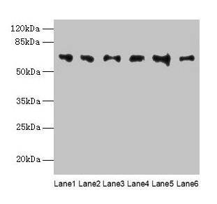 FBXO24 Antibody - Western blot All lanes: FBXO24 antibody at 1µg/ml Lane 1: Mouse gonadal tissue Lane 2: Mouse kidney tissue Lane 3: A549 whole cell lysate Lane 4: 293T whole cell lysate Lane 5: Jurkat whole cell lysate Lane 6: MCF-7 whole cell lysate Secondary Goat polyclonal to rabbit IgG at 1/10000 dilution Predicted band size: 65, 37, 70, 64 kDa Observed band size: 65 kDa