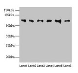 FBXO24 Antibody - Western blot All lanes: FBXO24 antibody at 1µg/ml Lane 1: Mouse gonadal tissue Lane 2: Mouse kidney tissue Lane 3: A549 whole cell lysate Lane 4: 293T whole cell lysate Lane 5: Jurkat whole cell lysate Lane 6: MCF-7 whole cell lysate Secondary Goat polyclonal to rabbit IgG at 1/10000 dilution Predicted band size: 65, 37, 70, 64 kDa Observed band size: 65 kDa