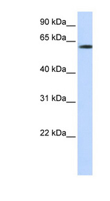 FBXO24 Antibody - FBXO24 antibody Western blot of Transfected 293T cell lysate. This image was taken for the unconjugated form of this product. Other forms have not been tested.