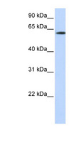 FBXO24 Antibody - FBXO24 antibody Western blot of Transfected 293T cell lysate. This image was taken for the unconjugated form of this product. Other forms have not been tested.