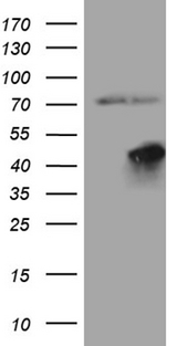 FBXO25 Antibody - HEK293T cells were transfected with the pCMV6-ENTRY control. (Left lane) or pCMV6-ENTRY FBXO25. (Right lane) cDNA for 48 hrs and lysed. Equivalent amounts of cell lysates. (5 ug per lane) were separated by SDS-PAGE and immunoblotted with anti-FBXO25. (1:2000)