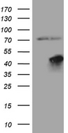 FBXO25 Antibody - HEK293T cells were transfected with the pCMV6-ENTRY control. (Left lane) or pCMV6-ENTRY FBXO25. (Right lane) cDNA for 48 hrs and lysed. Equivalent amounts of cell lysates. (5 ug per lane) were separated by SDS-PAGE and immunoblotted with anti-FBXO25. (1:2000)