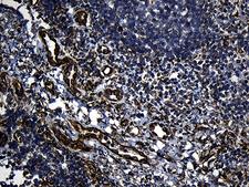 FBXO25 Antibody - Immunohistochemical staining of paraffin-embedded Human lymph node tissue within the normal limits using anti-FBXO25 mouse monoclonal antibody. (Heat-induced epitope retrieval by 1mM EDTA in 10mM Tris buffer. (pH8.5) at 120°C for 3 min. (1:150)(1:500)