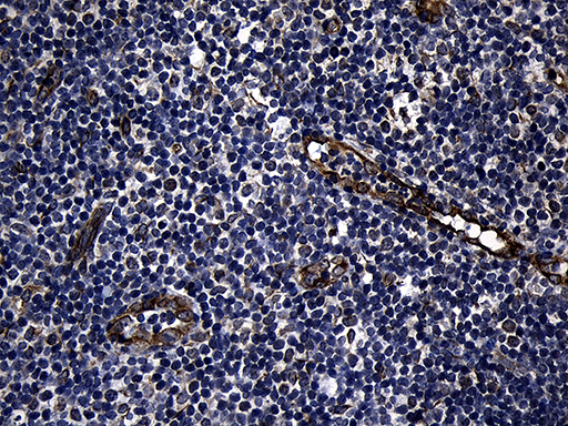 FBXO25 Antibody - Immunohistochemical staining of paraffin-embedded Human tonsil within the normal limits using anti-FBXO25 mouse monoclonal antibody. (Heat-induced epitope retrieval by 1mM EDTA in 10mM Tris buffer. (pH8.5) at 120°C for 3 min. (1:150)(1:500)