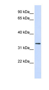 FBXO25 Antibody - FBXO25 antibody Western blot of Fetal Heart lysate. This image was taken for the unconjugated form of this product. Other forms have not been tested.