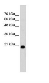FBXO25 Antibody - HepG2 Cell Lysate.  This image was taken for the unconjugated form of this product. Other forms have not been tested.