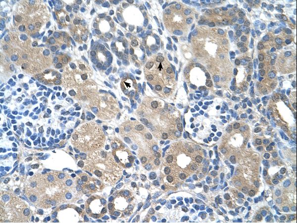 FBXO25 Antibody - FBXO25 antibody ARP43118_T100-EAW51453-FBXO25(F-box protein 25) Antibody was used in IHC to stain formalin-fixed, paraffin-embedded human kidney.  This image was taken for the unconjugated form of this product. Other forms have not been tested.