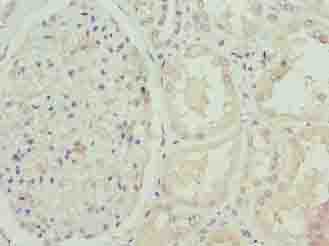 FBXO25 Antibody - Immunohistochemistry of paraffin-embedded human kidney tissue using antibody at dilution of 1:100.