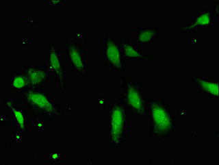FBXO25 Antibody - Immunofluorescent analysis of Hela cells using FBXO25 Antibody at dilution of 1:100 and Alexa Fluor 488-congugated AffiniPure Goat Anti-Rabbit IgG(H+L)
