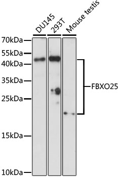 FBXO25 Antibody - Western blot analysis of extracts of various cell lines, using FBXO25 antibody at 1:1000 dilution. The secondary antibody used was an HRP Goat Anti-Rabbit IgG (H+L) at 1:10000 dilution. Lysates were loaded 25ug per lane and 3% nonfat dry milk in TBST was used for blocking. An ECL Kit was used for detection and the exposure time was 90s.