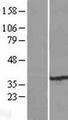 FBXO25 Protein - Western validation with an anti-DDK antibody * L: Control HEK293 lysate R: Over-expression lysate