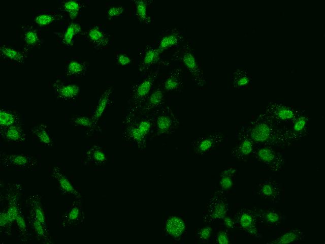 FBXO27 Antibody - Immunofluorescence staining of FBXO27 in PC3 cells. Cells were fixed with 4% PFA, permeabilzed with 0.1% Triton X-100 in PBS, blocked with 10% serum, and incubated with rabbit anti-Human FBXO27 polyclonal antibody (dilution ratio 1:200) at 4°C overnight. Then cells were stained with the Alexa Fluor 488-conjugated Goat Anti-rabbit IgG secondary antibody (green). Positive staining was localized to Nucleus and Cytoplasm.