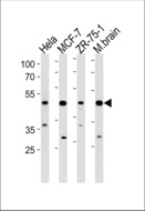 FBXO28 Antibody - FBXO28 Antibody western blot of HeLa,MCF-7,ZR-75-1 cell line and mouse brain lysates (35 ug/lane). The FBXO28 antibody detected the FBXO28 protein (arrow).