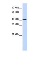 FBXO28 Antibody - FBXO28 antibody Western blot of MCF7 cell lysate. This image was taken for the unconjugated form of this product. Other forms have not been tested.