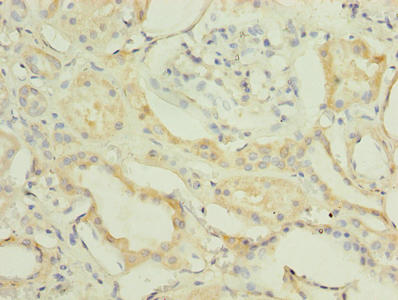 FBXO28 Antibody - Immunohistochemistry of paraffin-embedded human kidney tissue using FBXO28 Antibody at dilution of 1:100