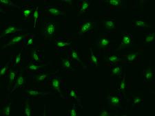FBXO28 Antibody - Immunofluorescence staining of FBXO28 in HeLa cells. Cells were fixed with 4% PFA, permeabilzed with 0.1% Triton X-100 in PBS, blocked with 10% serum, and incubated with rabbit anti-Human FBXO28 polyclonal antibody (dilution ratio 1:1000) at 4°C overnight. Then cells were stained with the Alexa Fluor 488-conjugated Goat Anti-rabbit IgG secondary antibody (green). Positive staining was localized to Nucleus.